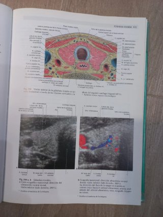 Atlas de Anatomía Humana de Sobotta. 2 volúmenes.