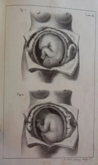 Curso completo de partos. 1834