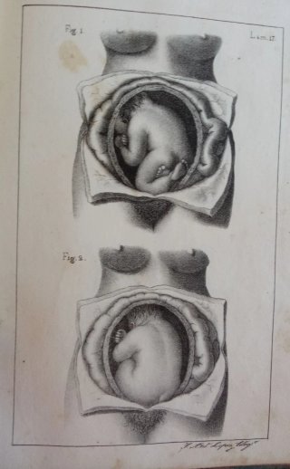 Curso completo de partos. 1834