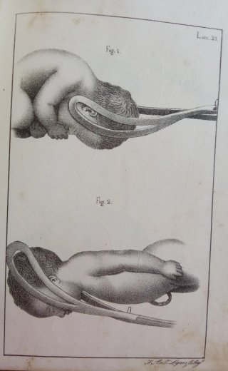Curso completo de partos. 1834