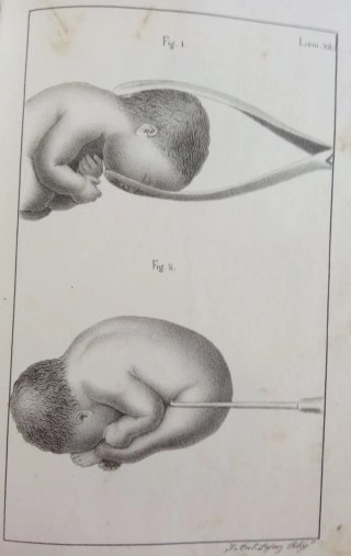 Curso completo de partos. 1834
