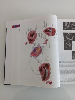 Braunwald tratado de cardiología texto de medic...