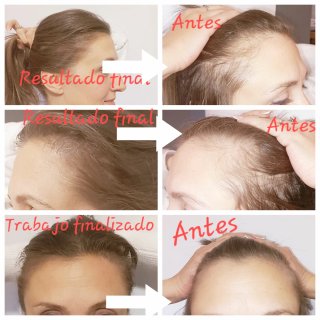 Micropigmentación cejas y cabeza