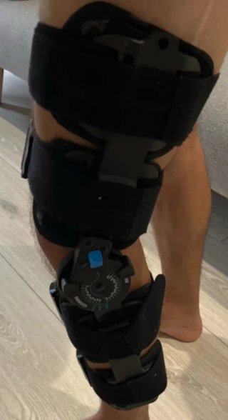 Prótesis ortopédica rodilla