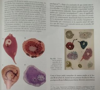 Neurología. Sistema nervioso. Medicina