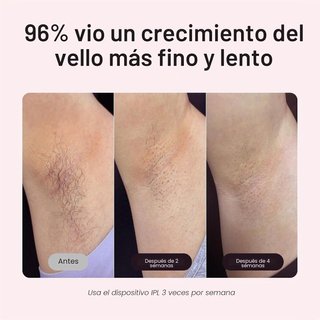 Depiladora IPL Wavytalk 24J Oro/Blanco
