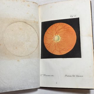 Libro 1863 Lang Sullo Stato Della Scienza Glaucoma