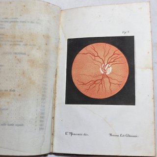 Libro 1863 Lang Sullo Stato Della Scienza Glaucoma