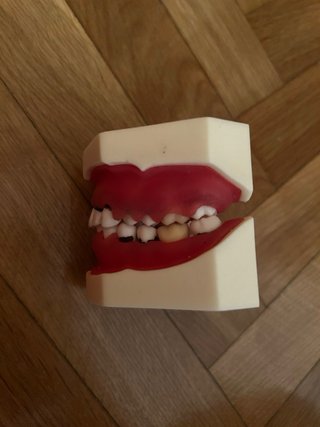 Tipodonto Periodoncia Bader