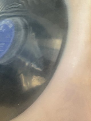 Vinilo