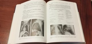 Radiología general compendio analítico semiológico
