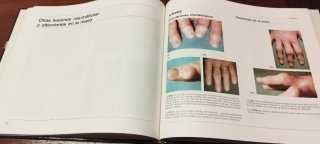 Atlas Reumatología