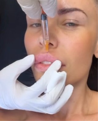 Belleza