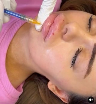 Belleza