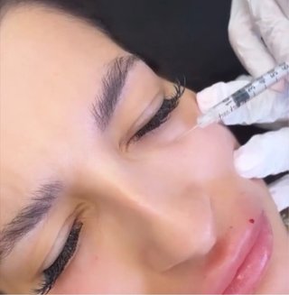 Belleza