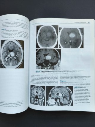 Merritt's Neurology 12th Edition
