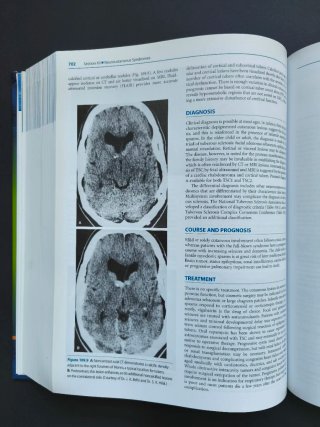 Merritt's Neurology 12th Edition