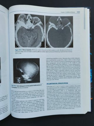 Merritt's Neurology 12th Edition