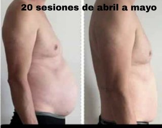 Masajes profesionales