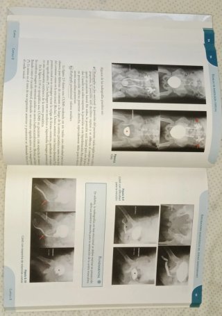 Técnicas de radiología especial