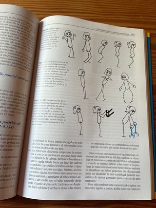 Tratamiento de la parálisis cerebral y del retr...