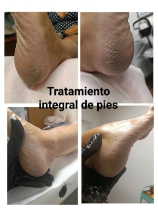 Masajes REDUCTORES(Burgos)