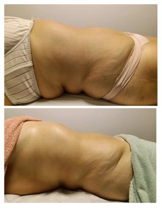 Masajes REDUCTORES(Burgos)