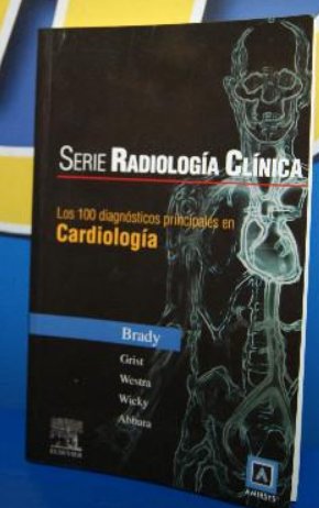 4 libros medicina, cardiología: Síndrome Aórtico Agudo - Auscultación Cardíaca Fácil -manual y mas