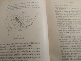 Libro Antiguo: Medios para evitar el embarazo