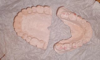 Regalo Molde de dientes escayola