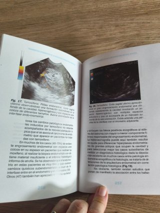 Ultrasonografía ginecológica