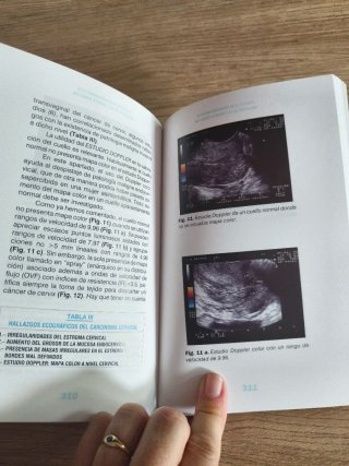 Ultrasonografía ginecológica