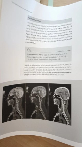 Técnicas de imagen en medicina nuclear