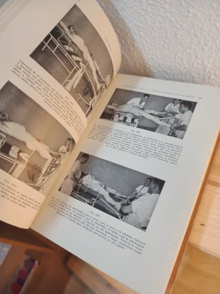 Técnica del tratamiento de las fracturas