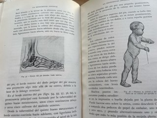 Anatomía artística
