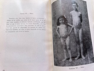 Anatomía artística