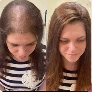 EXTENSIONES Y TRANSFORMACIONES CAPILARES | BENIDOR