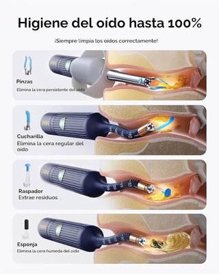 Bebird EarSight Plus I35R Cámara Oído 1080P