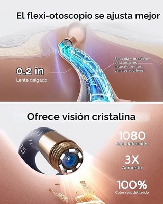 Bebird EarSight Plus I35R Cámara Oído 1080P