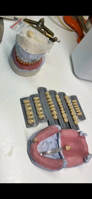 Dentista y Prótesis dental