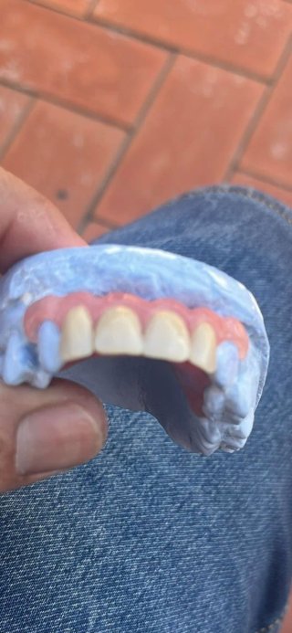 Dentista y Prótesis dental