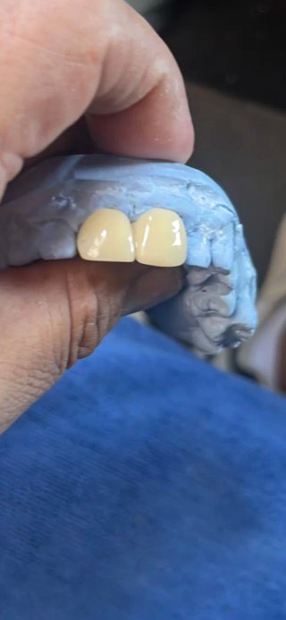 Dentista y Prótesis dental