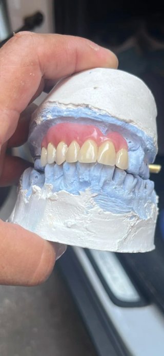 Dentista y Prótesis dental