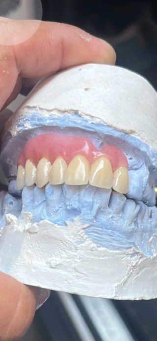 Dentista y Prótesis dental