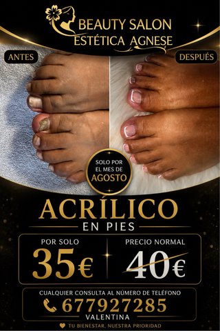 Belleza