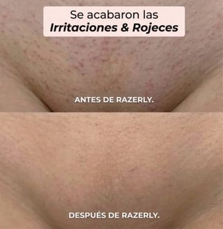 Maquinilla Razerly 2en1 Bikini/Cuerpo NUEVO