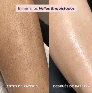 Maquinilla Razerly 2en1 Bikini/Cuerpo NUEVO