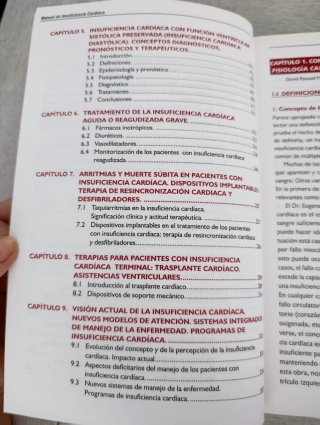 Manual de insuficiencia cardíaca diagnóstico y ...