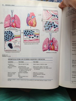 Enfermeria y Cancer De la Serie Mosby de Enferm...