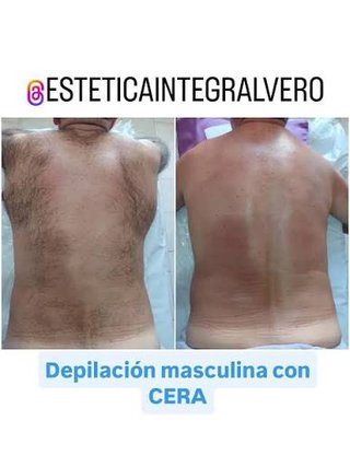 MASAJE  +DEPILACION INTIMA